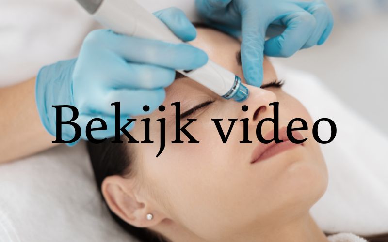 Diamonds Beauty uit Rotterdam verzorgt de volgende beauty behandleingen: ontharen, microneedling & gezichtsbehandelingen. Tot ziens in onze beauty salon!