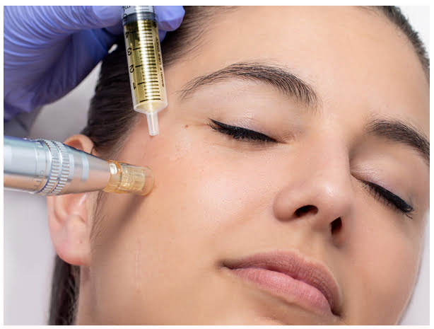 Diamonds Beauty uit Rotterdam verzorgt de volgende beauty behandleingen: ontharen, microneedling & gezichtsbehandelingen. Tot ziens in onze beauty salon!