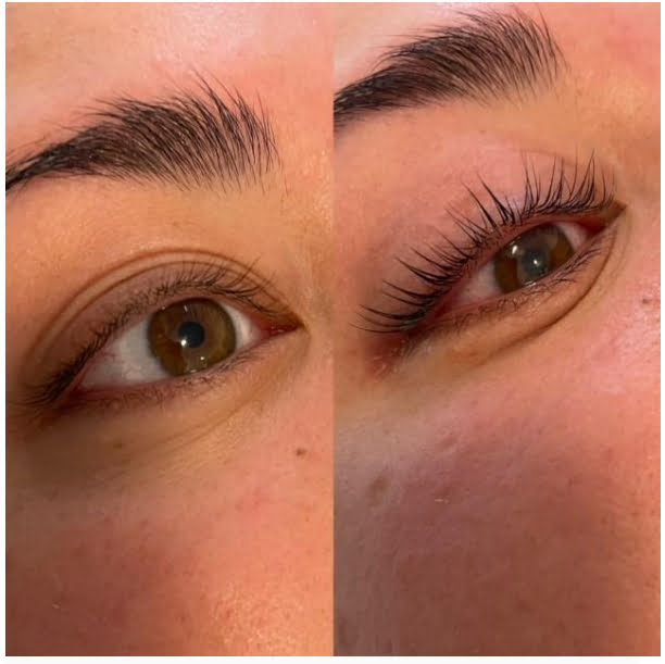 Diamonds Beauty uit Rotterdam verzorgt de volgende beauty behandleingen: ontharen, microneedling & gezichtsbehandelingen. Tot ziens in onze beauty salon!